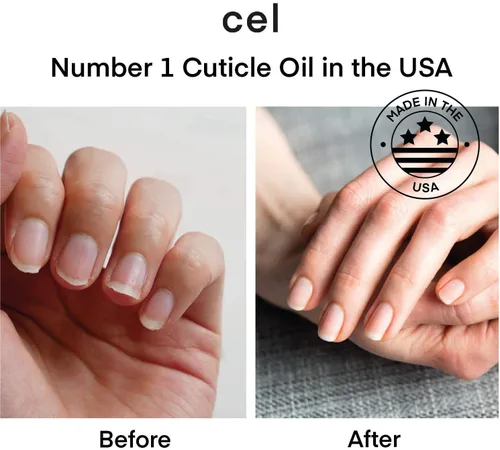 Miniatura 3 de cel MD - Pluma de aceite para cutículas, suero reparador de uñas – Reparación de uñas para uñas dañadas – Ayuda a reparar y nutrir las uñas