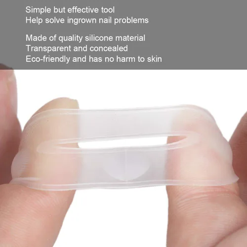 Miniatura 4 de Corrector de uñas encarnadas, 2 piezas de herramienta de corrección de uñas encarnadas de silicona, corrector de uñas encarnadas, tratamiento