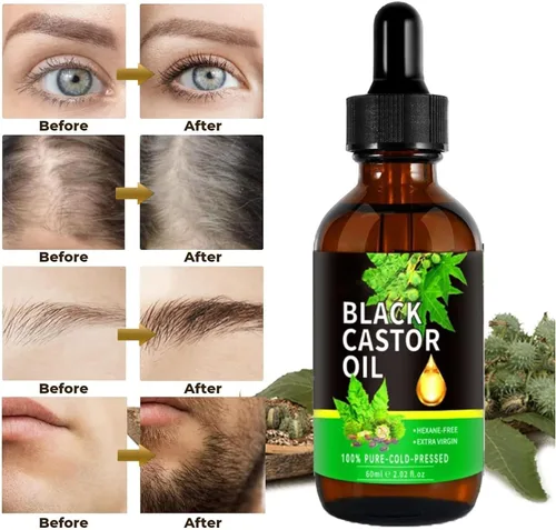 Miniatura 3 de Aceite de Ricino y Castor Orgánico Puro para Crecimiento del Cabello, Pestañas, Cejas y Vello de Mujeres y Hombres - 2.0 fl oz/2.0 Fl Oz 1 Botella