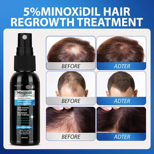 Miniatura 3 de Tratamiento de pérdida de cabello de minoxidil al 5% para hombres, minoxidil para mujeres, aerosol para el crecimiento del cabello, para hombres