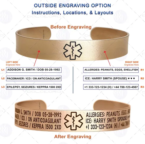 Miniatura 17 de Pulsera de identificación de alerta médica, acero inoxidable 316L, personaliza y personaliza, selecciona un tamaño de muñeca, de 6 a 9 pulgadas