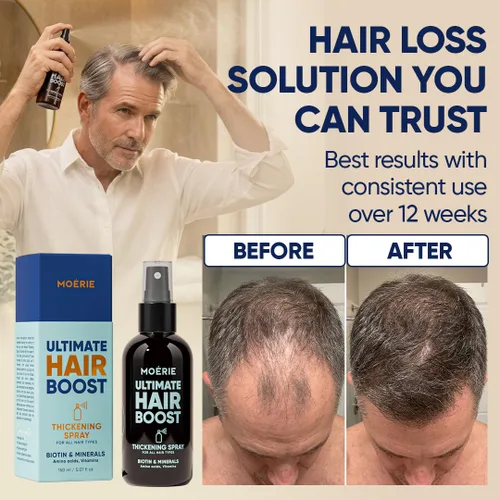 Miniatura 5 de Moerie Ultimate Hair Boost Spray diseñado para fortalecer el cabello y restaurar la salud del cuero cabelludo, suero 100% natural para el cabello
