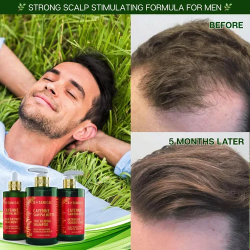 Miniatura 4 de Acondicionador botánico para el crecimiento del cabello, "desintoxicación del cuero cabelludo", terapia intensiva contra la pérdida de cabello