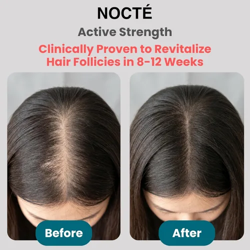 Miniatura 3 de Nocte Spray de suero de crecimiento del cabello minoxidil al 5% para hombres y mujeres – Biotina, cafeína y complejo botánico de romero, tratamiento