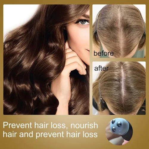 Miniatura 3 de Juego de 10 rodillos de suero orgánico para el crecimiento del cabello, kit de regeneración del cabello orgánico, triple masajeador enrollable