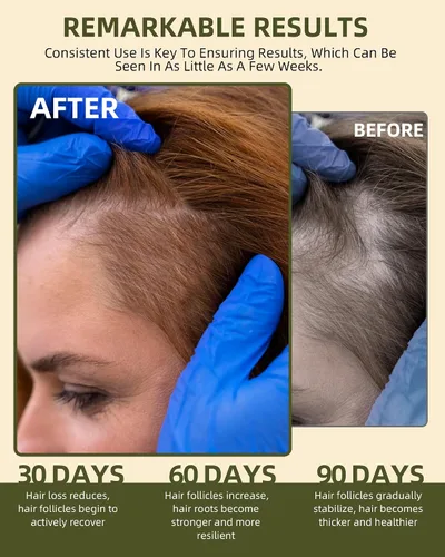 Miniatura 3 de Aceite de batana crudo 100% natural para el crecimiento del cabello, aceite de crecimiento del cabello Dr. Sebi de Honduras, cabello más grueso