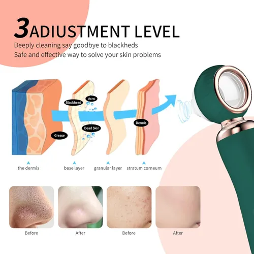 Miniatura 4 de 2025 - Aspiradora de poros para eliminar puntos negros, limpiador de poros facial recargable visual, 3 succiones de silicona suave, 3 sondas, kit