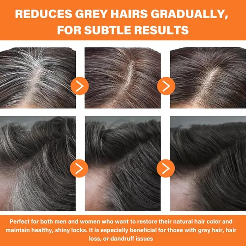 Miniatura 8 de Barra inversa de cabello gris + juegos de aerosol, para hombres y mujeres, cubre el suero de cabello gris, jabón acondicionador para engrosar