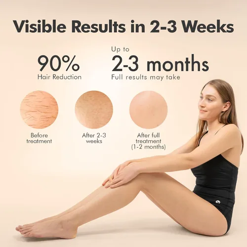 Miniatura 2 de Aberlite Luxe - Dispositivo de depilación láser IPL para mujeres y hombres, sin dolor con enfriamiento de zafiro, doble pulso, escaneo automático, 4