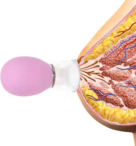 Miniatura 4 de Jesakmie Corrector de pezón rosa para pezones planos invertidos para lactancia materna madre o mujeres taza de vacío