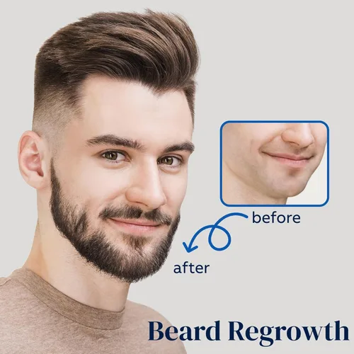Miniatura 3 de FUZYAT 5% Spray de Minoxidil para Hombres y Mujeres, Minoxidil para el Crecimiento del Cabello en Mujeres, Spray de Minoxidil para el Crecimiento