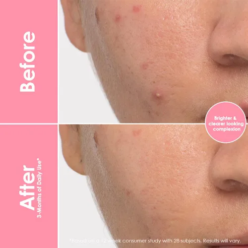 Miniatura 4 de Grande Cosmetics Gomitas veganas de colágeno para el cabello, la piel, las pestañas y las cejas para mujeres con biotina, ácido fólico, vitamina C