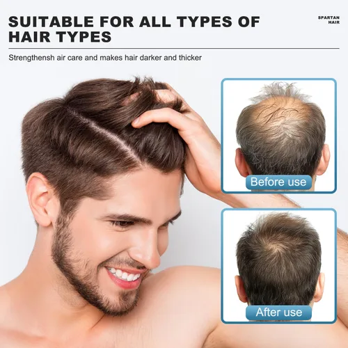Miniatura 5 de Champú Activador de Raíces para Hombres - Sistema Fortalecedor y Suavizante para Cabello Fino y Canoso - Añade Volumen y Nutre las Mechas - Para