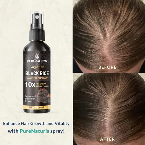 Miniatura 4 de PureNaturis Aceite de ricino y jengibre para el crecimiento del cabello, suero sin enjuague para hombres y mujeres, eficaz para la pérdida