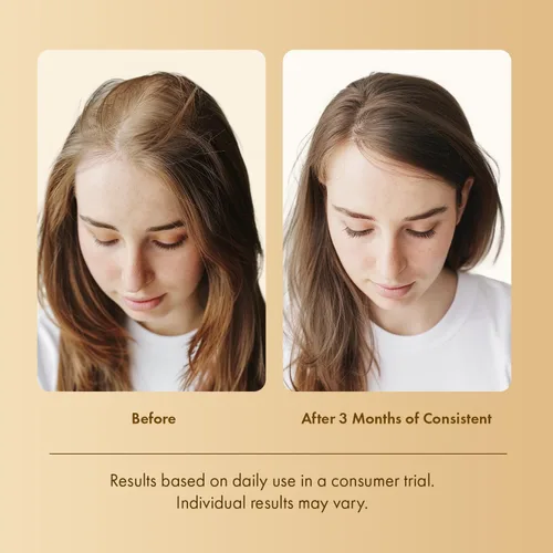 Miniatura 6 de Tratamiento del cuero cabelludo con suero para el crecimiento del cabello: suero para el cuero cabelludo con romero, multipéptido y cafeína