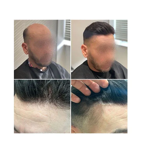 Miniatura 8 de LYRICAL HAIR Tupé de cabello humano para hombres, totalmente polivinílico, tupé para hombre, totalmente transparente, suave, delgada, 0.004-0.005