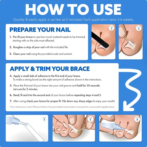 Miniatura 8 de Tratamiento del hogar para uñas encarnadas CurveCorrect