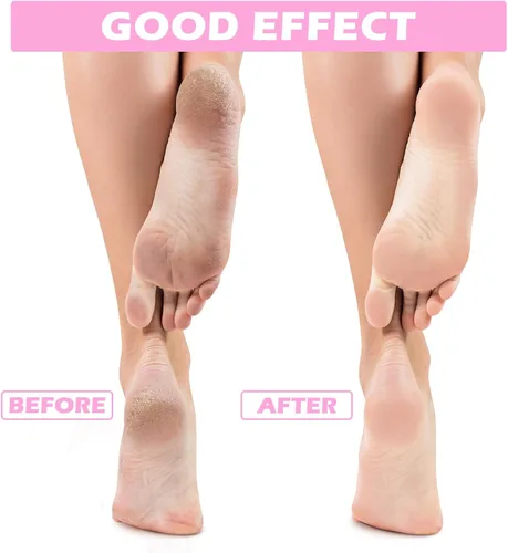 Miniatura 4 de Tarpop 3 pares de calcetines de aloe para mujer, calcetines de spa hidratantes para el día de San Valentín, para pies secos y agrietados, gel
