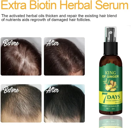 Miniatura 2 de Shouga Kingu Aceite de jengibre para el crecimiento del cabello, aceite germinal de 7 días, control de caída del cabello, tratamiento para cabello