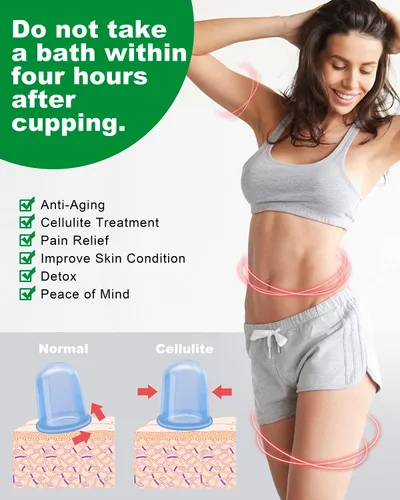 Miniatura 3 de Juegos de terapia de ventosas de silicona, masajeador de copa anticelulitis - Ventosa de succión al vacío para tratamiento de celulitis - Increíble