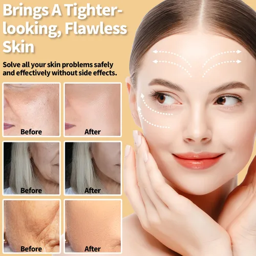 Miniatura 4 de Terapia de luz roja para la cara, aprobada por la FDA, masajeador facial de terapia de luz LED UUPAS para cara, máquina de apriete de la piel