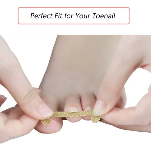 Miniatura 2 de EBANKU Tiras de tratamiento de uñas encarnadas, 20 piezas de parche de corrección de uñas de los pies, parche elástico, corrector de pedicura