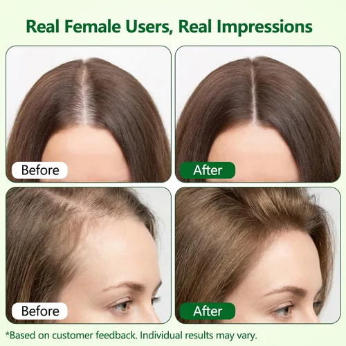 Miniatura 3 de Suero roll-on para el crecimiento del cabello, ayuda a reducir la caída del cabello y promueve un cabello más grueso y de aspecto más completo