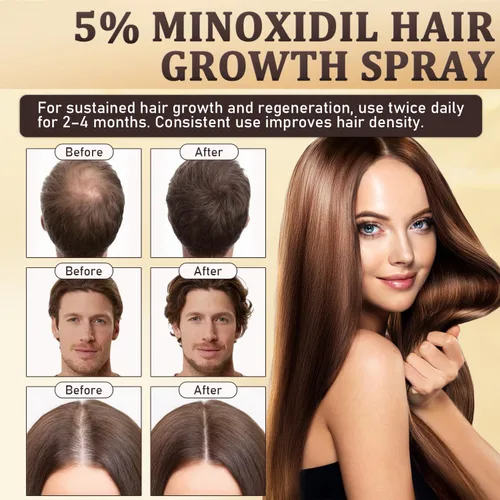 Miniatura 5 de Spray de minoxidil al 5% para hombres y mujeres, suero de biotina para el crecimiento del cabello con extractos de romero y batana, tratamiento