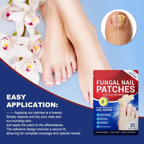 Miniatura 5 de Tratamiento de hongos en las uñas de los pies extra fuerte – 21 parches de uñas de hongos, parches de reparación de uñas, 8 horas de adherencia