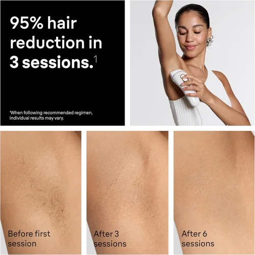 Miniatura 4 de Braun IPL Silk·Expert Pro 5 PL5347 - Sistema de depilación en casa de última generación para mujeres y hombres, resultados de larga duración, 3