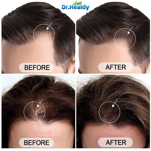 Miniatura 6 de Dr.Healdy - Champú de aceite de batana para el crecimiento del cabello, contra la pérdida de cabello e hidrata, reduce la rotura, fórmula sin
