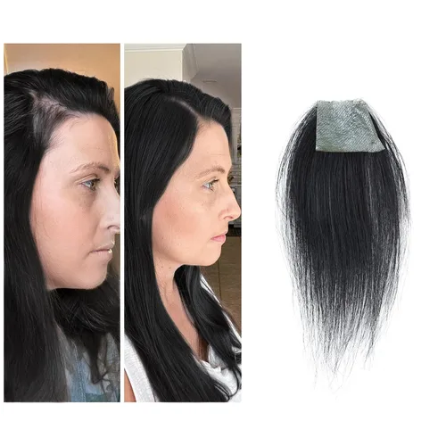 Miniatura 40 de Reemplazo de cabello humano con cicatrices, quemaduras accidentales sin vello para hombres y mujeres, pérdida de línea de cabello, cinta recta
