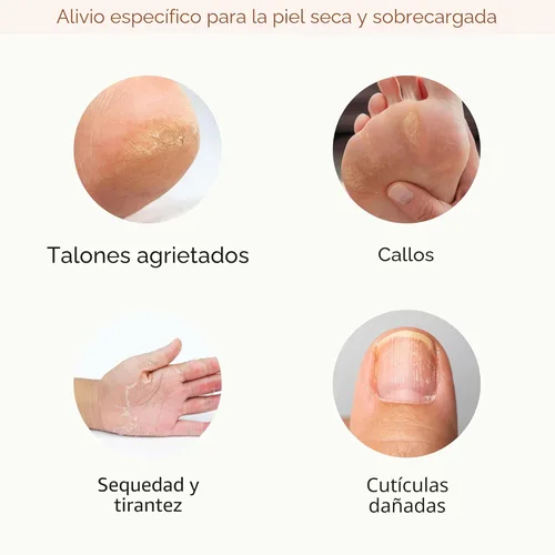 Miniatura 4 de Epielle Mascarillas Hidratantes e Humectantes para Manos y Pies, Alivian y Suavizan la Piel Seca y Áspera, Regalos de Cuidado Personal para Mujeres