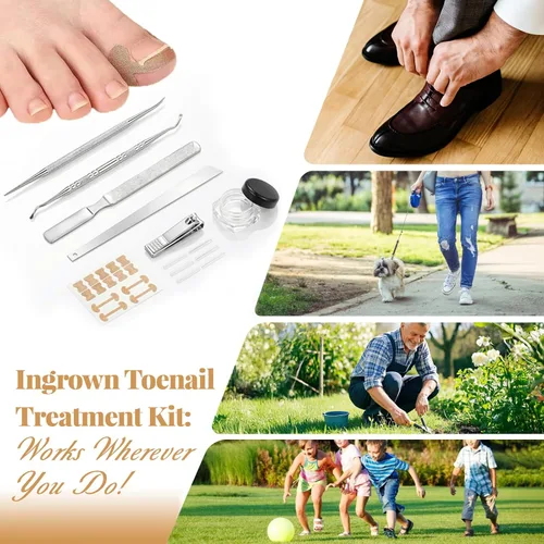 Miniatura 7 de Kit de eliminación y corrector de uñas encarnadas para un alivio rápido del dolor, kit profesional de tratamiento de uñas encarnadas con tiras