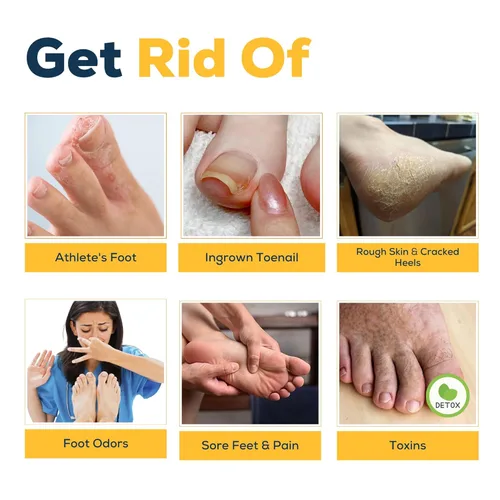 Miniatura 6 de FOOT CURE Remojo de desintoxicación cítrico para pies con sales de Epsom – para callos de pies, apariencia de uñas de los dedos dañadas, pedicura