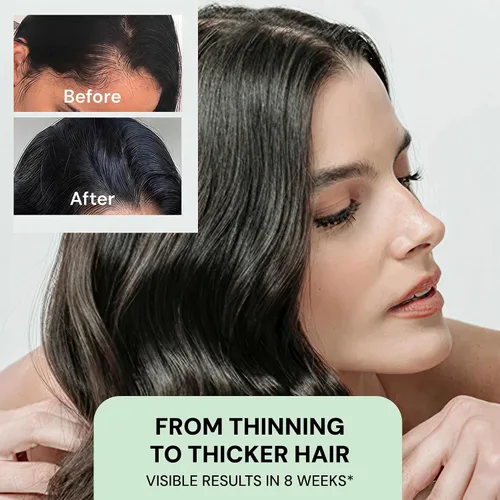 Miniatura 5 de YBERA VELLO SERUM PARA DEFINIMIENTO DEL CABELLO con tecnología avanzada ALFA-LACTOBABY, suero para el cuero cabelludo para el crecimiento