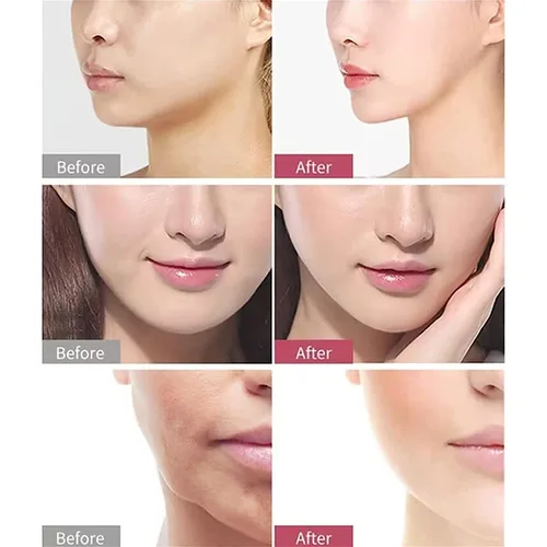Miniatura 5 de Máscara de sueño para esculpir la cara de belleza, máscara facial que moldea la línea V, máscara de elevación facial con correa adelgazante