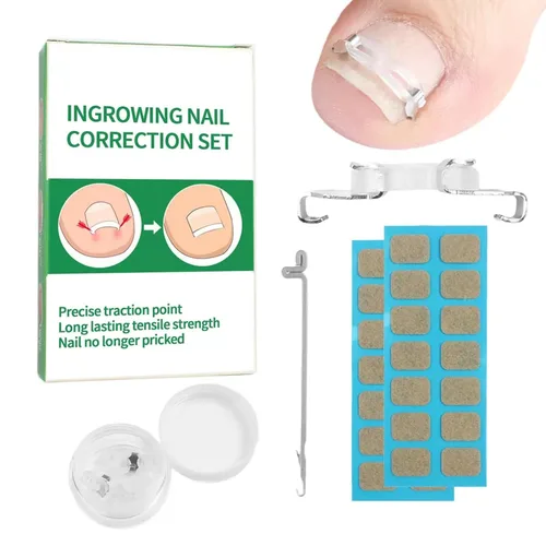 Kit corrector de uñas encarnadas para hombres y mujeres, herramienta de uñas encarnadas, 2 clips de acero inoxidable, tiras de uñas curvas y