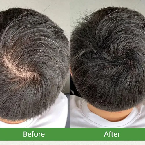 Miniatura 9 de Usma Grass - Barra de champú sólido para adelgazar el cabello, barras de rutina de jugo Usman para engrosar y oscurecer, pérdida de cabello