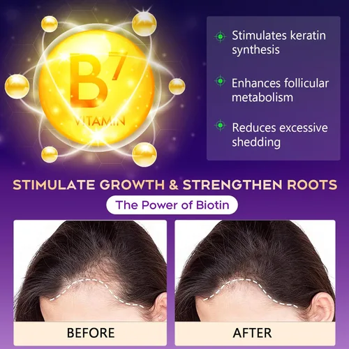 Miniatura 3 de Biotin - Champú para el crecimiento y engrosamiento del cabello con activador de raíces, champú para la pérdida de cabello para hombres y mujeres