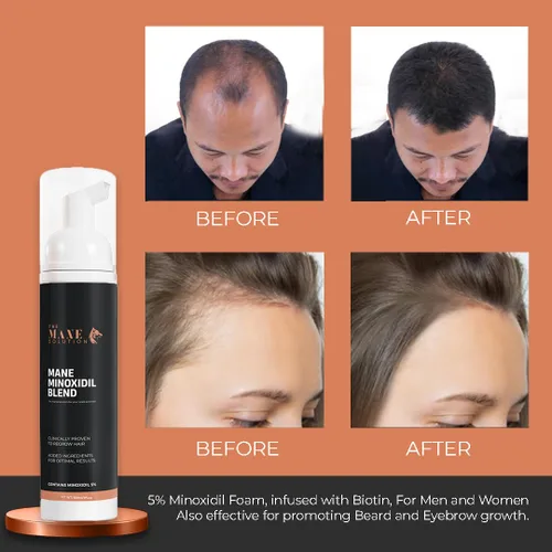 Miniatura 3 de The Mane Minoxidil Blend Foam 5%: Hecho para el crecimiento del cabello, tratamiento anti pérdida de cabello, suero para el crecimiento del cabello
