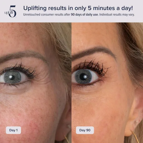 Miniatura 3 de Elevación facial pulsante Dispositivo de reversión de edad de 5 minutos, contornea y mejora las estructuras faciales, tensando y tonificando