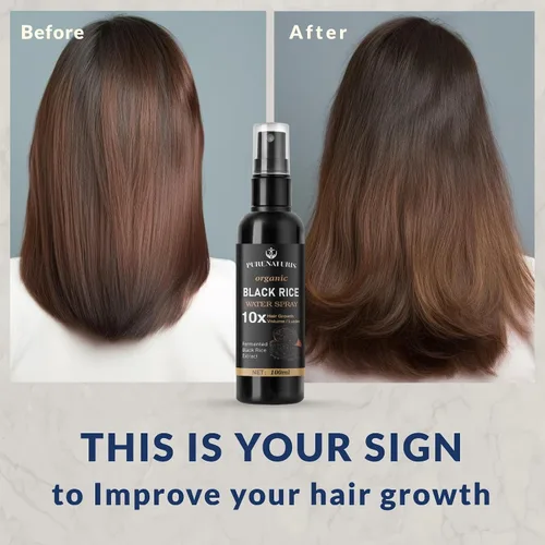 Miniatura 8 de PureNaturis Aceite de ricino y jengibre para el crecimiento del cabello, suero sin enjuague para hombres y mujeres, eficaz para la pérdida