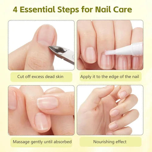 Miniatura 4 de Nailz - Bolígrafo de crecimiento de uñas radiante, bolígrafo de aceite de crecimiento de uñas radiante, aceite de cutícula para uñas, fortalecedor