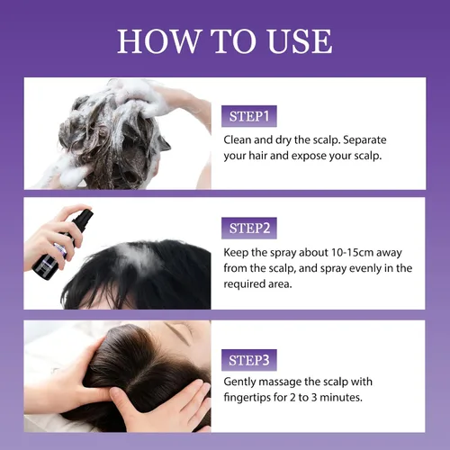 Miniatura 3 de Spray de minoxidil al 5% para tratamiento de crecimiento del cabello, paquete de 2, evita el adelgazamiento, promueve un cabello más fuerte y lleno