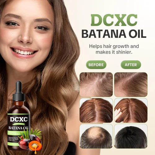 Miniatura 5 de Aceite de batana 100% puro para el crecimiento del cabello, cuidado natural del cuero cabelludo y tratamiento de engrosamiento del cabello