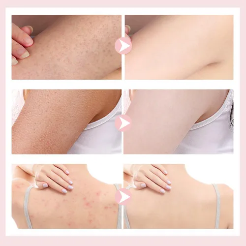 Miniatura 7 de Bola de Baño con Ventosa Girasol Super Suave, Nueva Bola de Baño 2-en-1 Girasol 2025 con Anillos para los Dedos, Esponja de Baño Exfoliante