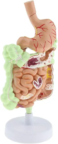 Miniatura 5 de KESOTO Modelo de Patología Gastrointestinal Humana Modelo Coronal Gástrico del Tracto Digestivo para Estudiantes Escolares Aprendizaje