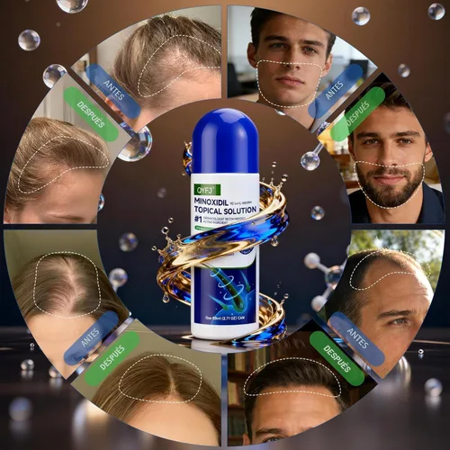 Miniatura 3 de Paquete de 3 sueros de minoxidil al 5% para hombres y mujeres, minoxidil para el crecimiento de la barba y el cabello (infusión de biotina)