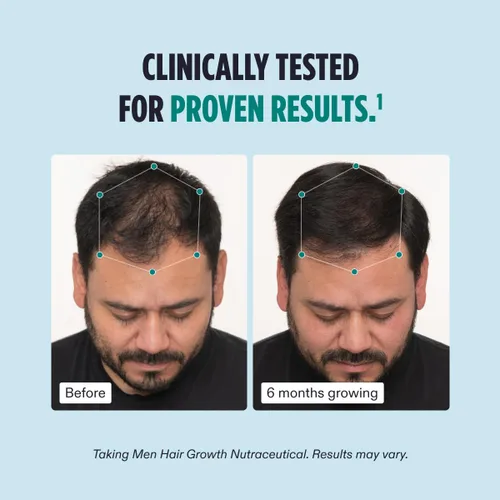 Miniatura 4 de Nutrafol Suplemento para el crecimiento del cabello para hombres y péptidos de colágeno en polvo, formulado por médicos para un cabello visiblemente